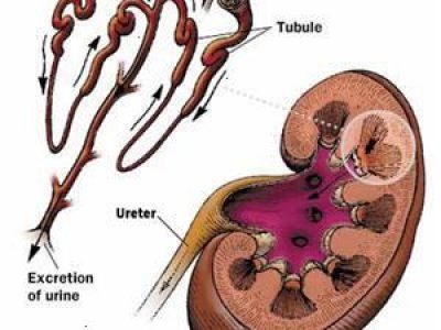 Glomerulonefritt