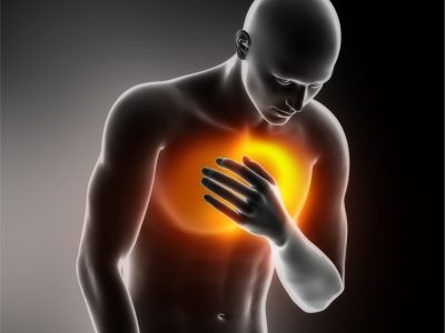 Hjerteinfarkt